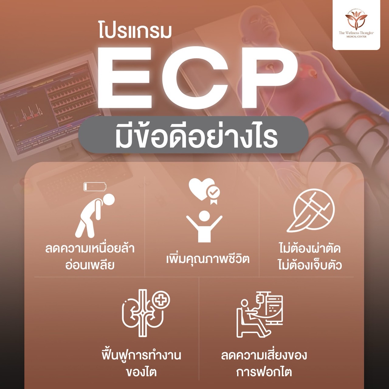 ข้อดีของ ECP