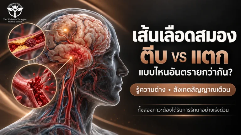 เส้นเลือดในสมองตีบ vs แตกแบบไหนอันตรายกว่ากัน ?